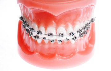 メタルブラケット